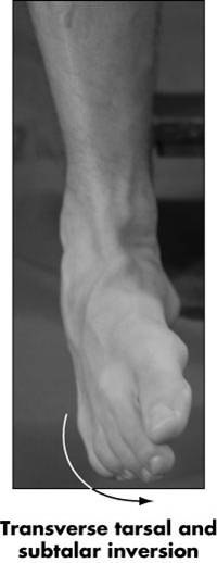 Peroneus Longus Plantaris Soleus Gastrocnemius Flexor Digitorum