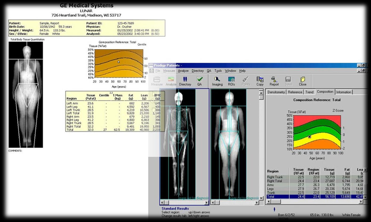 DEXA 23