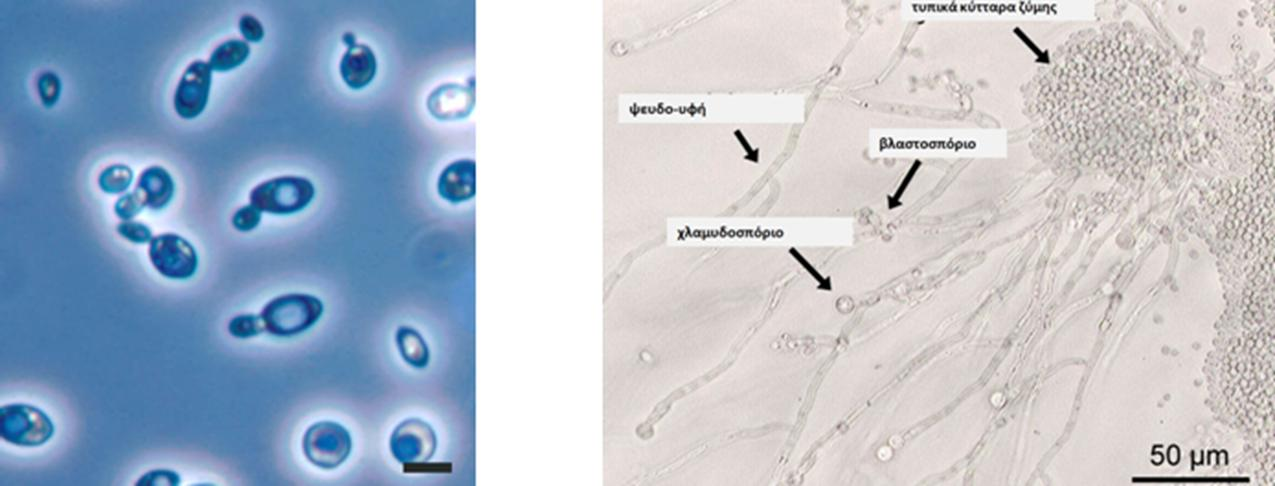 ΥΠΟΦΥΛΟ SACCHAROMYCOTINA Μορφολογία κυττάρων ζύμης Κύτταρα ζύμης (ορισμένα σε διαδικασία διαίρεσης) του