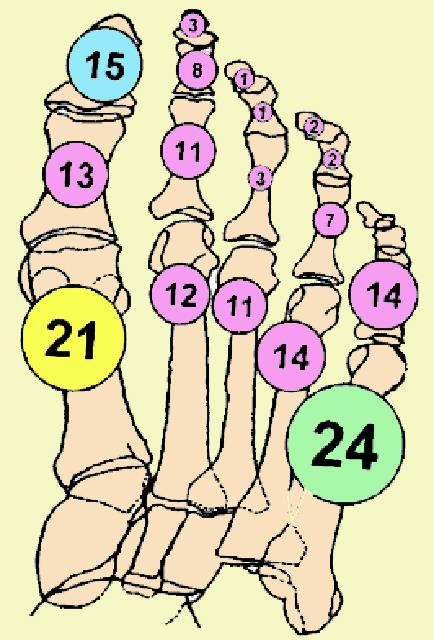 MR Image Analysis of Pedal Osteomyelitis: