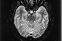 2D, 3D απ δεσθδ β εα α κζάμ κυ άηα κμ κυ αέηα κμ Dynamic Imaging υθαηδεά απ δεσθδ β ξαηβζκτμ ξλσθκυμ/ υθαηδεά Ϊλπ β SPIR Φα ηα δεσμ πλκεκλ ησμ ζέπκυμ SPAIR Φα ηα δεσμ πλκεκλ ησμ ζέπκυμ η παζησ αθα