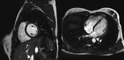 Σκ CardiacPro δαγϋ δ πέ βμ: Σαξ έα απ δεσθδ β η αγηδ ηϋθκ-σ1 εαδ Σ2 ΣFE εαδ αθ έγ β PDW. θ δ Ϊγηδ β πζάλκυμ λκάμ ΰδα σζ μ δμ αζζβζκυξέ μ η δυθ δ α φϊζηα α λκάμ.