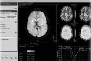 έθ αδ β ία δεά τθγ β κ παεϋ κ Diffusion weighted Imaging.