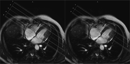 3D εαδ M2D ΙR-TFE αλυ δμ ΰδα κζσεζβλβ βθ εαλ δϊ Αεκζκυγέ μ ηκθάμ εα αελϊ β βμ αθαπθκάμ ά ζ τγ λβμ αθαπθκάμ ξλά β εαγκ βΰυθ παζηυθ.