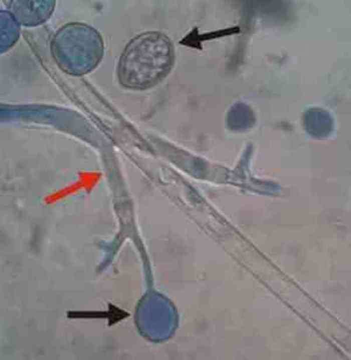 Εικόνα 25: Peronospora sp. Το γένος Peronospora είναι το δεύτερο σπουδαιότερο γένος της οικογένειας Peronosporaceae και προκαλεί και εκείνος µε τη σειρά του την ασθένεια του περονόσπορου.