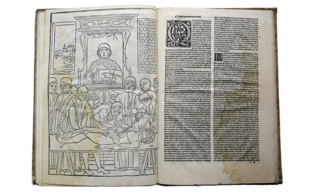 Fasciculus medicine [Βενετία, Gregorius de Gregoriis, 1513] Ταξιθετικός #: ΙΑΤΡ-335 Σχήμα 4ο Διαστάσεις: 31 x 21,5 x 1,2 εκ.