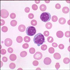 Lymphocytes T or B Function in