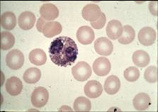 Eosinophils Stain with acidic