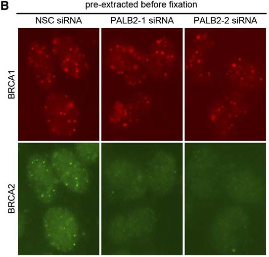 πώλεια BRCA2 από τις πυρηνικές δομές μετά από PALB-2 sirna κατεργασία NSC (Non-Specific