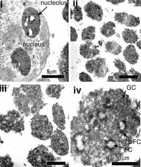 (Andersen et al., 2002) Σχήµα Α.5. Πυρηνίσκοι από κύτταρα HeLa. i-iv. Αποµονωµένοι πυρηνίσκοι, όπως φαίνονται σε ηλεκτρονικό µικροσκόπιο, µε αυξανόµενη µεγέθυνση.