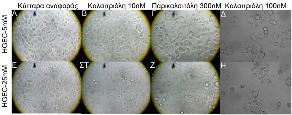 Αποτελέσματα ποδοκύτταρα στην εικόνα 25Α και 25Ε καλλιεργήθηκαν απουσία διεγέρτη, ενώ τα ποδοκύτταρα στην εικόνα 25Β και 25ΣΤ καλλιεργήθηκαν για τέσσερις ημέρες παρουσία καλσιτριόλης τελικής