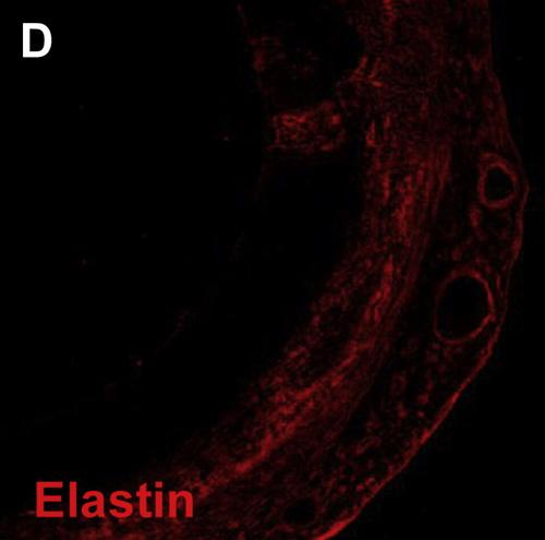 ΕΛΑΣΤΙΝΗ Μεταλλαγές σε γονίδιο ελαστίνης ( ανεπάρκεια πρωτεΐνης) σε άνθρωπο και ποντικό: Στένωση αορτής ή άλλων αρτηριών (Εκτεταμένη