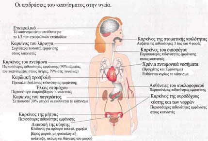 Επισκεφθείτε την ιστοσελίδα: ΣΕ ΣΥΝΕΡΓΑΣΙΑ ΜΕ ΤΟΥΣ ΚΑΘΗΓΗΤΕΣ ΤΗΣ ΠΛΗΡΟΦΟΡΙΚΗΣ Η ΤΩΝ ΑΓΓΛΙΚΩΝ. http://www.bupa.co.