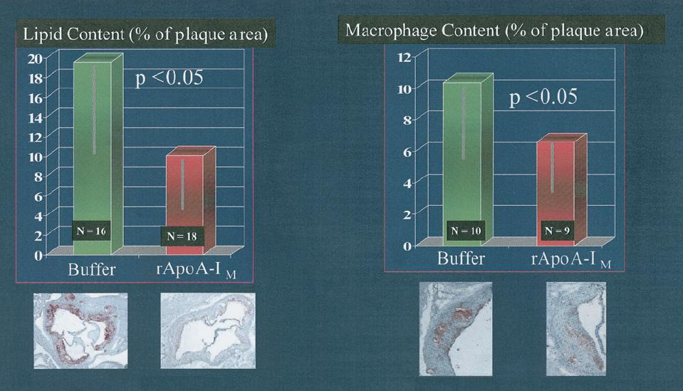 A single intravenous injection of rapoa-i M phospholipid complex reduces aortic plaque lipid