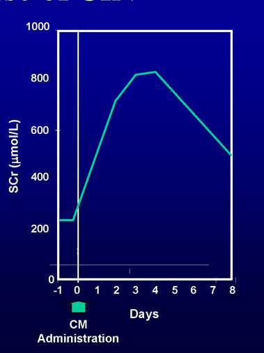 Time Course of CIN Increase in SCr within 1 to 2 days because of decreased GFR Peak at 3-4 days after CM