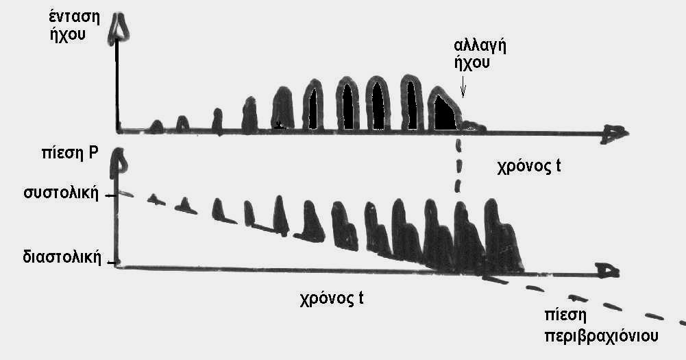 αρτηριακής