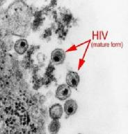 [12]. 1.3.1 Ταξινόμηση του HIV Ο ιός της ανθρώπινης ανοσοανεπάρκειας (HIV) ανήκει στην οικογένεια των ρετροϊών.