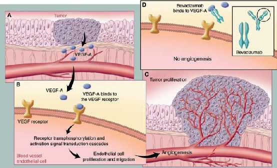 Εικόνα 4 (41). Η διαδικασία της αγγειογένεσης και ο μηχανισμός δράσης της bevacizumab ( Avastin).