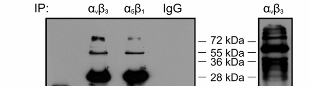 Αποτελέσματα κύτταρα, αυτή η αλληλεπίδραση ελέγχθηκε αν ισχύει και στο in vivo μοντέλο της χοριοαλλαντοϊκής μεμβράνης εμβρύου όρνιθας (CAM), όπου είναι γνωστό ότι η ιντεγκρίνη α ν β 3 εκφράζεται στα