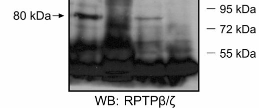 υπομονάδες της ιντεγκρίνης αλληλεπιδρούν με ισομορφές του RPTPβ/ζ. Αυτό που δε διευκρινίσθηκε ήταν με ποια από τις ισομορφές του RPTPβ/ζ αλληλεπιδρά η κάθε υπομονάδα.