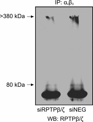 Αποτελέσματα Εικόνα Α21: Η ισομορφή του υποδοχέα RPTPβ/ζ μοριακής μάζας ~80 kda μειώνεται μετά από παροδική διαμόλυνση των κυττάρων HUVEC με παρεμβαλλόμενο RNA έναντι του RPTPβ/ζ (sirptρβ/ζ).