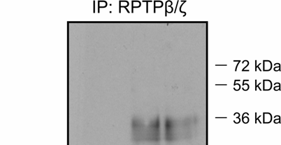 Αποτελέσματα Εικόνα Α31: Μελέτη του ρόλου του πεπτιδίου S1 στην αλληλεπίδραση της πλειοτροπίνης με τον RPTPβ/ζ. Κύτταρα HUVEC καλλιεργήθηκαν παρουσία (δεξιά) και απουσία (αριστερά) του πεπτιδίου S1.