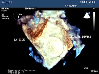 Echocardiography, book, Spingel-Verlag edition 2009. 2. lex Pui-Wai Lee, Yat-Yin Lam, Gabriel Wai-Kwok Yip, Roberto M Lang, Qing Zhang, Cheuk-Man Yu.