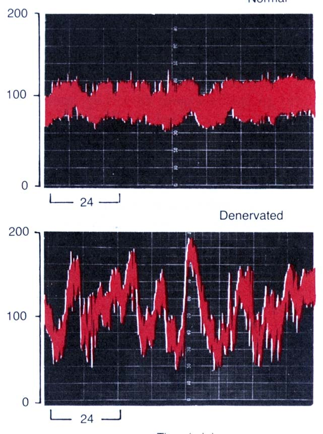 Baroreceptorski refleks Puferuju dnevne varijacije TA Funkcioniše tokom promene