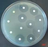 The high proportions of Salmonella, Campylobacter and indicator E. coli isolates exhibiting resistance to ciprofloxacin are of concern.