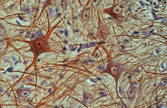 12. Ποια η μορφή και ποιος ο ρόλος του νευρικού ιστού; Από ποιούς τύπους κυττάρων αποτελείται ο νευρικός ιστός; Ο νευρικός ιστός αποτελείται από κύτταρα, ορισμένα από τα οποία αντιδρούν σε ερεθίσματα