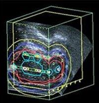 Τι είναι η 3D/4D υπερηχογραφία και βιοψία Υψίσυχνες κεφαλές. Ειδικές κεφαλές. Συνεχείς σαρώσεις του όγκου.