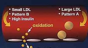 Γιατί τα μικρά LDL είναι πιο αθηρογόνα; 1) Ευκολότερη διείσδυση στο αρτηριακό τοίχωμα 2) Πιο επιρρεπή στην