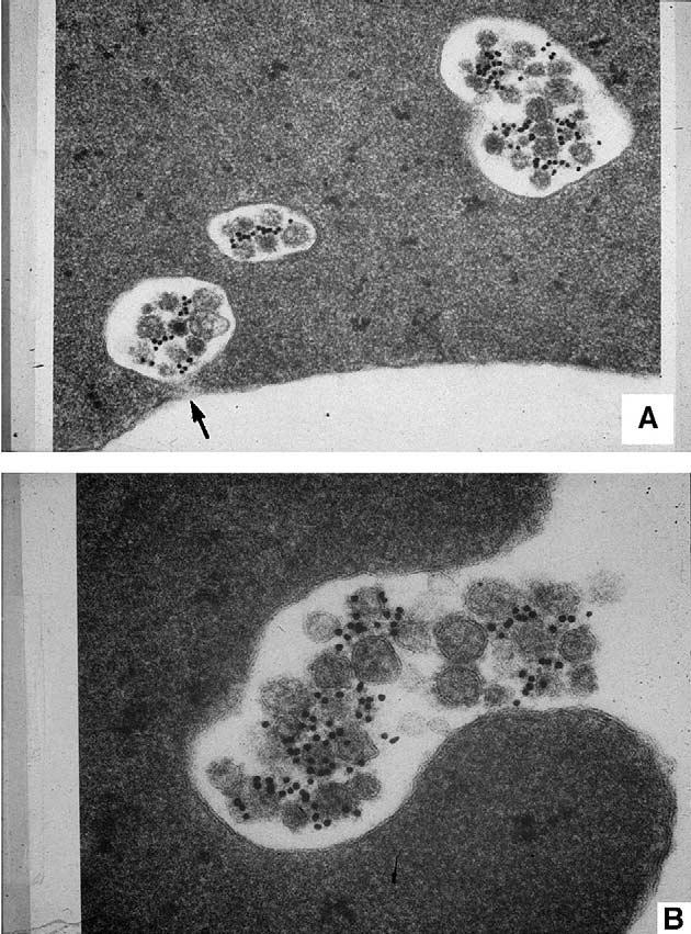 ΚΥΣΤΙΔΙΟΠΟΙΗΣΗ Εxosomes (A) Exosomes in maturing sheep RETs. 18h of incubation after surface labeling of sheep RETs with MoAb against the transferrin receptor.