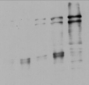 2) 90% actin (b5) 40% G3PD (b6) 40% band 8 65% Hb* >85% IgG s 80% Membrane