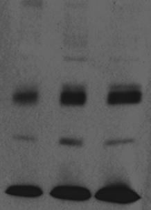 Band 3-based aging pathway C 4 10 17 22 30 35 43 Μembrane remodeling