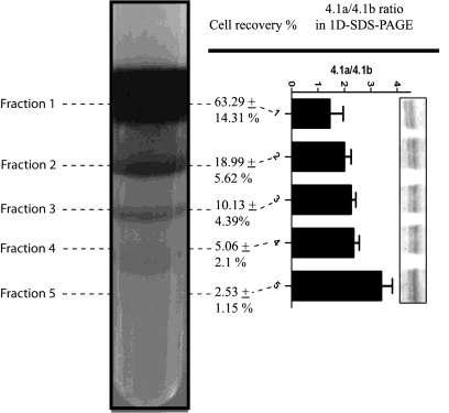 Γήρανση ερυθροκυττάρων Percoll density gradient of freshly drawn, RBC concentrates.