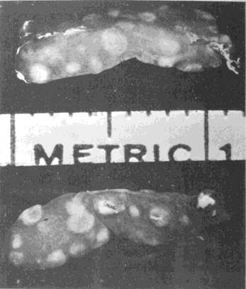 1961, Till and McCulloch πολυδύναμα αρχέγονα μυελικά κύτταρα όταν μεταμοσχευτούν (μετάγγιση) στο μυελό των οστών ομοιογονιδιακού πειραματοζώου που είχε προηγουμένως ακτινοβοληθεί με θανατηφόρες