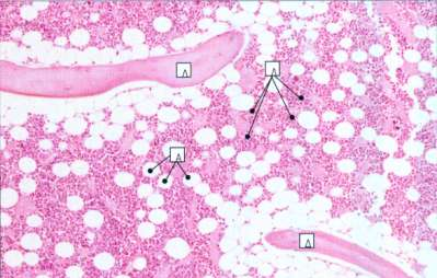 Mυελός των οστών - Μεγακαρυοκύτταρο Λιποκύτταρα εντοπίζονται στον αδρανή (κίτρινο) μυελό των