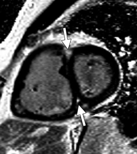 Cardiac