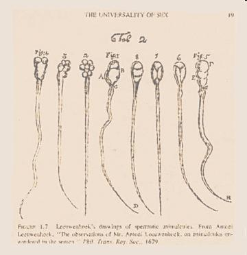 Σύντομη Αναδρομή στη Μικροβιολογία - Οι πρώτες παρατηρήσεις Ο Anton van Leeuwenhoek έγραψε λεπτομερή αναφορά στη Βασιλική Εταιρεία