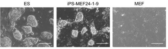Induced Pluripotent Cells (ips cells) Ιϊκή μεταγωγή