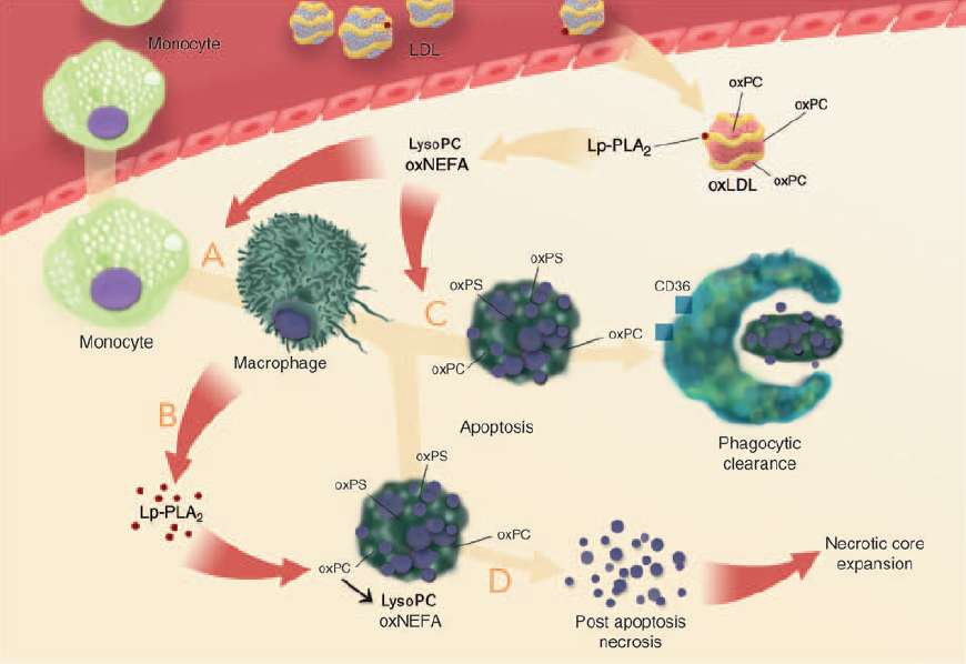 Role of Lp-PLA2 in plaque necrotic core formation