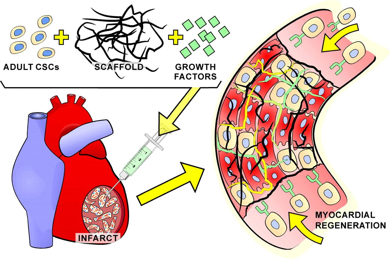 Tissue engineering and stem cells. Leri A et al.