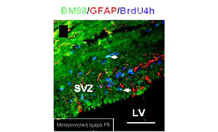 Αποτελέσματα πρόσθια υποκοιλιακή ζώνη (asvz) όπου η έκφραση της πρωτεΐνης ΒΜ88 στα πολλαπλασιαζόμενα κύτταρα ήταν πολύ εκτεταμένη (Εικόνα 8).