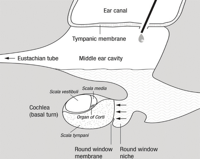 τυμπανικού υμένα με κατάλληλη βελόνη. Η μέθοδος αυτή είναι γρήγορη, οικονομική και Έξω ακουστικός πόρος Τυμπανικός υμένας Ευσταχιανή σάλπιγγα Μέσο ους Κοχλίας Στρογγυλή θυρίδα Σχήμα 9.