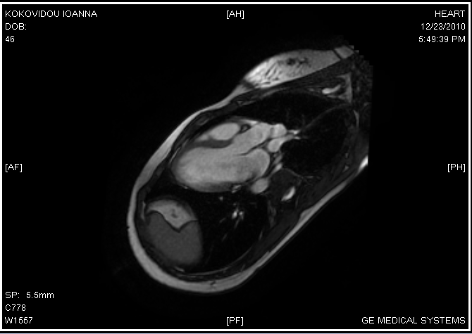 MRI