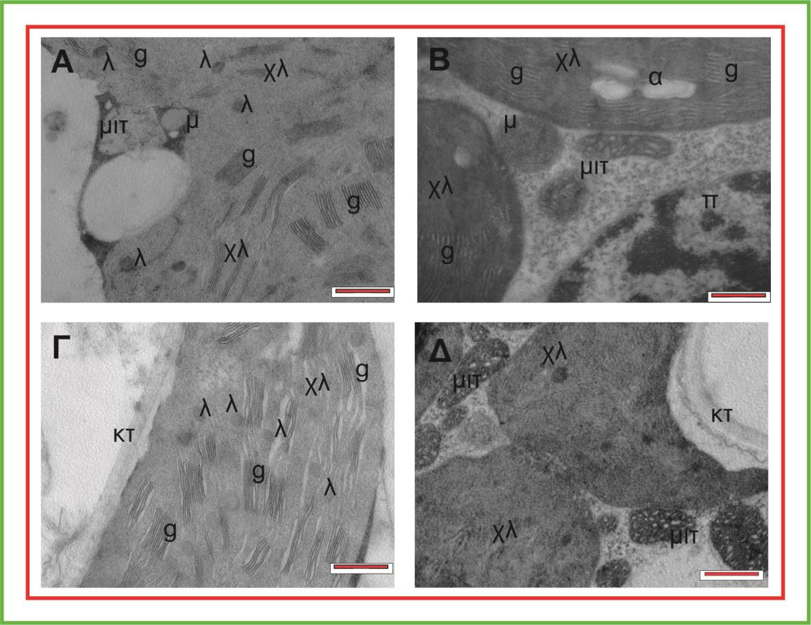 θυλακοειδών και των grana είναι πυκνότερη (Εικόνες 14.Β, Δ και 15.Β και Δ).