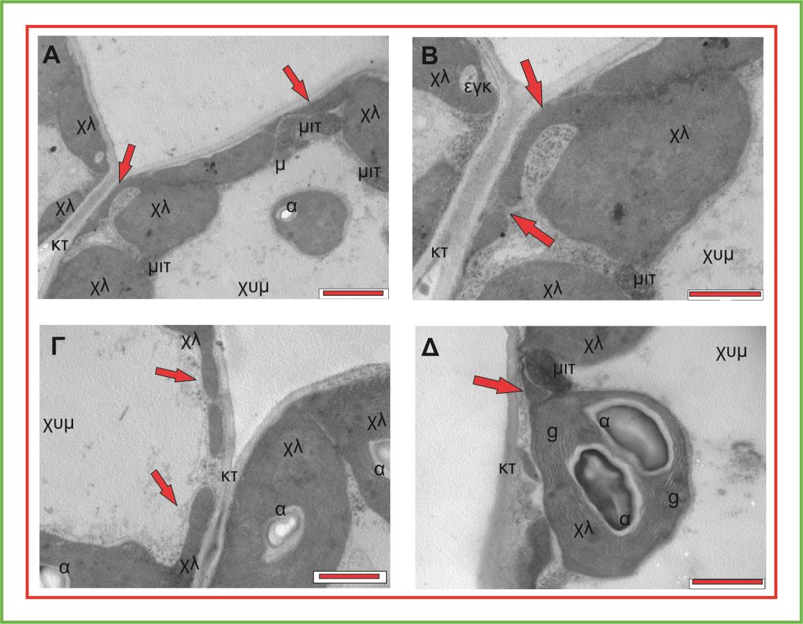 Εικόνα 15. Παρατήρηση με το Η.Μ.Δ. εγκάρσιων τομών φύλλου κριθαριού στην περιοχή του μεσοφύλλου υπό συνθήκες έντονης υδατικής καταπόνησης (επίπεδο υδατικής καταπόνησης D).