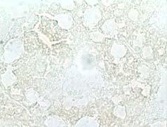 histochemistry (δ, θ,  During