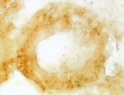 lipids and neutral lipids,